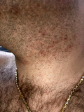 Collo iaquinta
